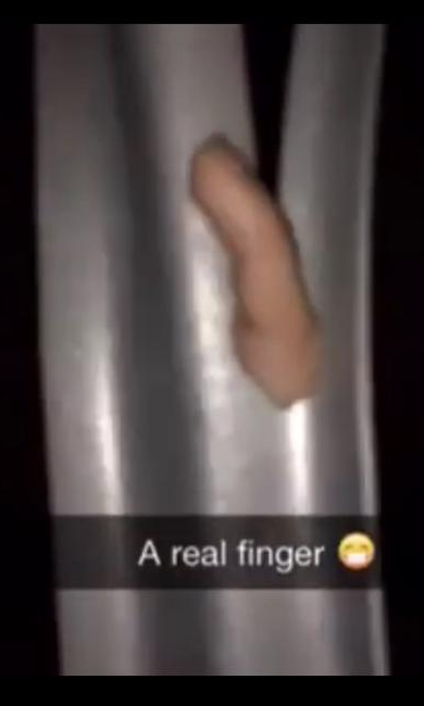 severed finger